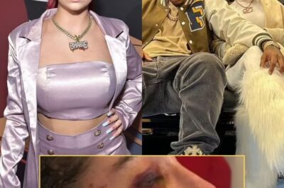 Bhad Bhabie reveals she had a nose job amid cancer battle as she hits back at critics: ‘Cleared by my doctor’