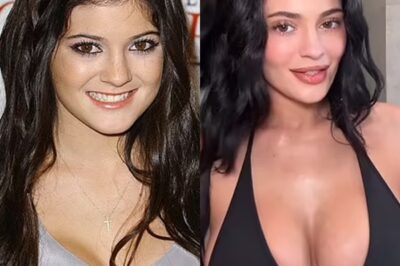 Radio stars share never before seen pictures of Kylie Jenner before she went under the knife after they called her the ‘ugly little one’