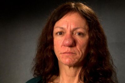 This 30-Year-Old Woman Got a Nose Job and Looks Unrecognizable After
