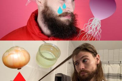 “Miracle Cure for Baldness? Onion Juice Secret Uncovered—Thousands Claim Hair Grows 3x Faster, Patches Vanish Overnight, and Even Alopecia Patients Report Full Recovery Without Drugs!” |D