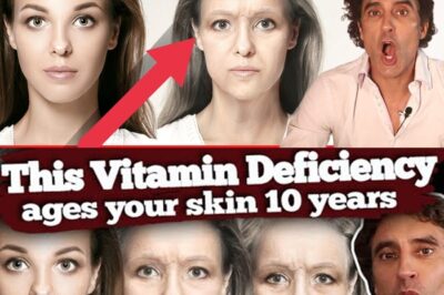 “Dermatologists Are Panicking: This One Vitamin Deficiency Could Be the Hidden Reason Your Face Is Aging 10 Years Faster – Stop the Wrinkles Before It’s Too Late!”