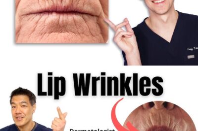 Discover the ultimate secret to instantly erase stubborn lip lines! Say goodbye to aging lips and wrinkles forever with these revolutionary treatments that Hollywood stars swear by — results so dramatic, people won’t believe their eyes. Don’t let lip wrinkles steal your youth — FIX them NOW!